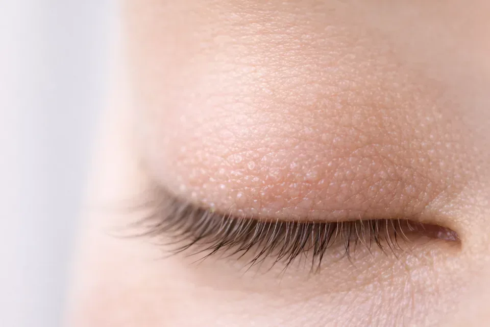 Demodex Blepharitis Treatment (UK)